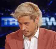 Milo Yiannopoulos looks down while wearing a shirt and blazer