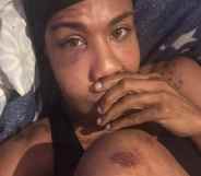 New York attack queer trans