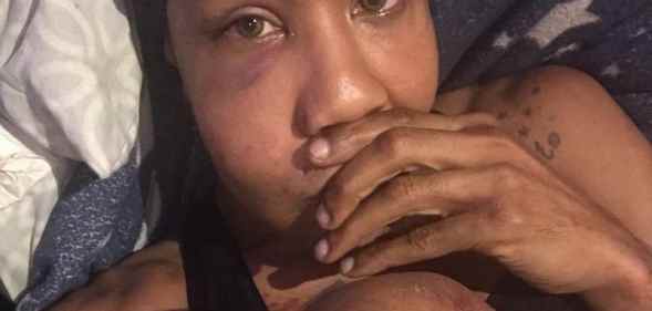 New York attack queer trans