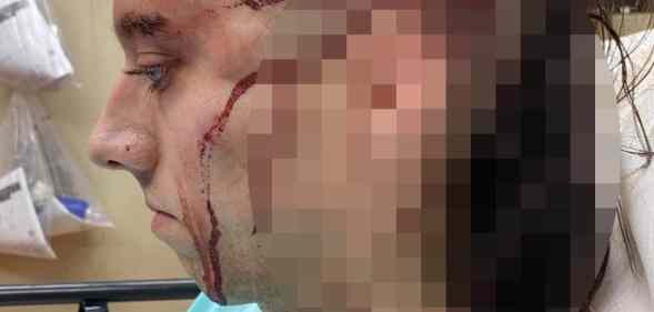 A blurred photo of a woman with a wound to the side of her head