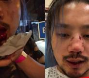 Side-by-side of Yang Wu, his mouth and nose bleeding