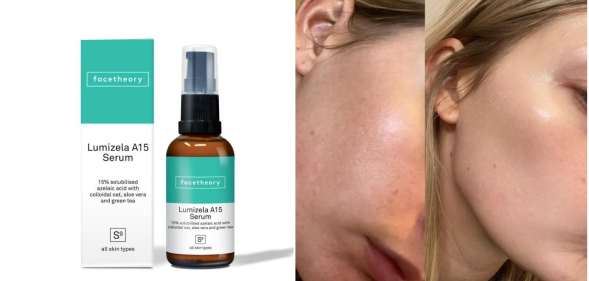 Facetheory's Lumizela Azelaic Acid Serum has been getting rave reviews.