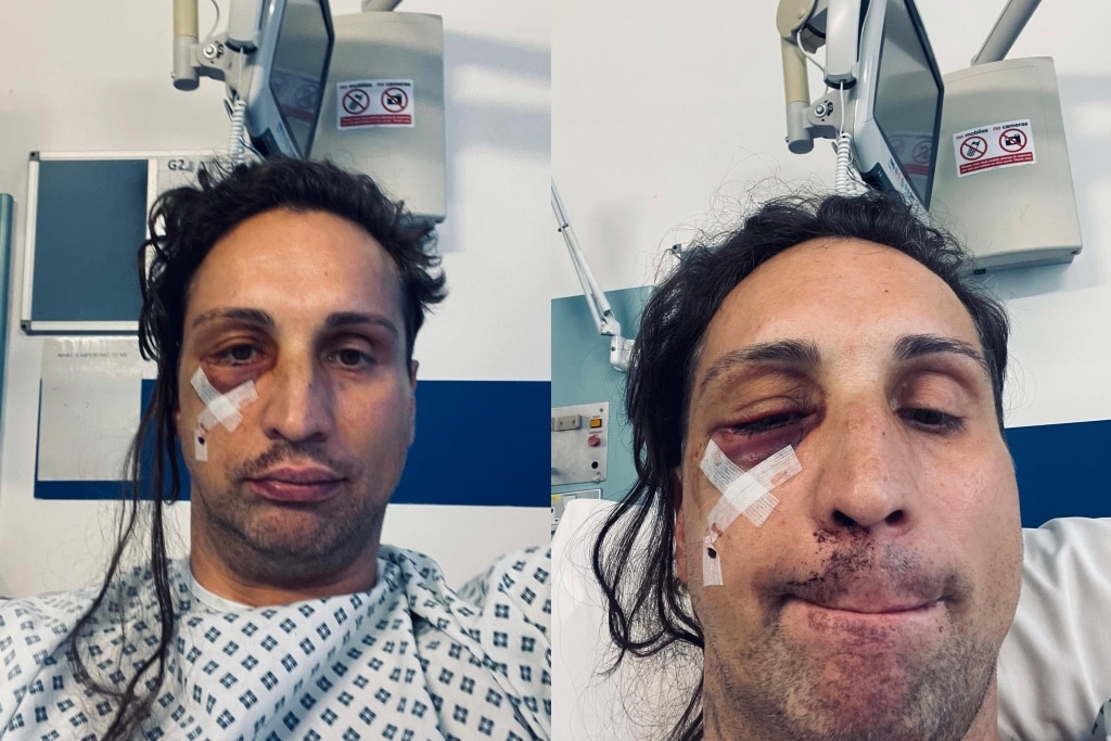 Lóránt-Árpád Tompos pictured in hospital after he was attacked in a homophobic hate crime