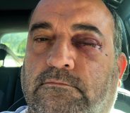 Matt Brooks, the latest LGBT+ person to be attacked in Birmingham