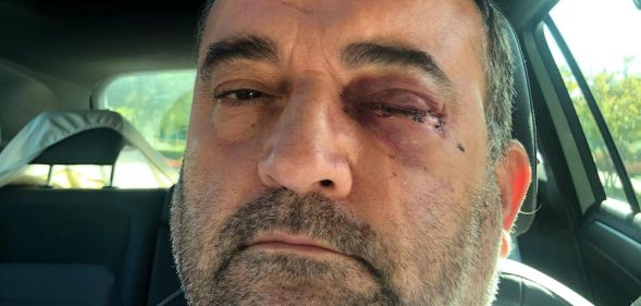 Matt Brooks, the latest LGBT+ person to be attacked in Birmingham