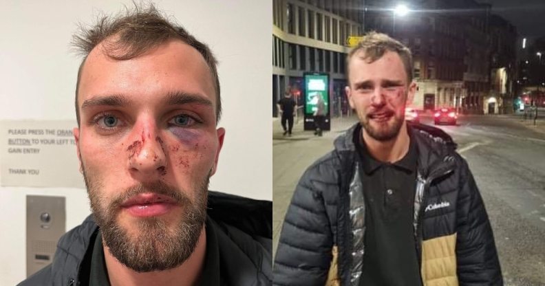 Side-by-side photographs of a young white man covered in blood and bruises