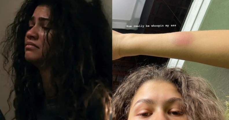 Zendaya ended up with bruises while filming Euphoria