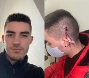 Side-by-side photos of Harry Batt, one of him smiling indoors and another of a cut on the side of his head