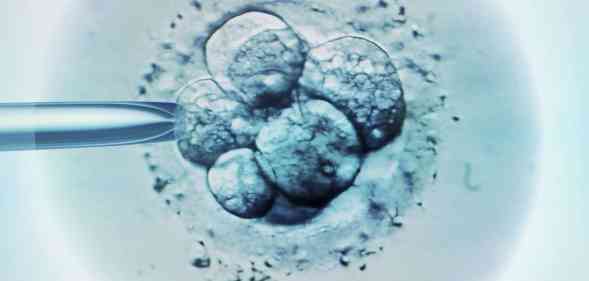 IVF Procedure