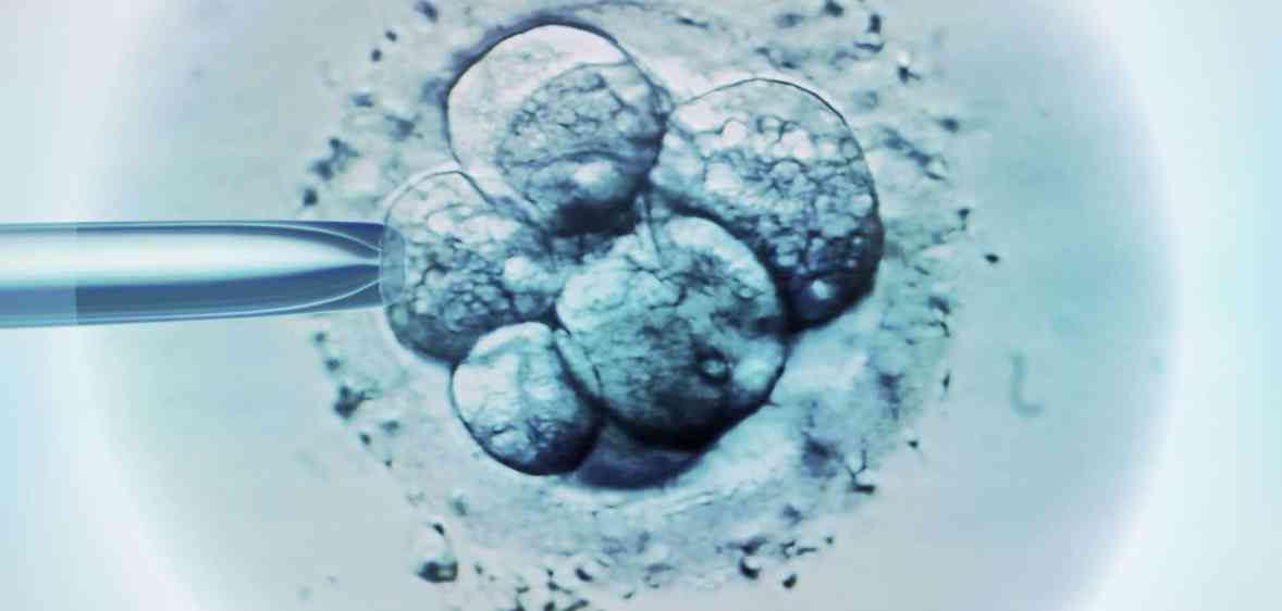 Lesbian couple who wanted female embryo sues IVF clinic over baby boy