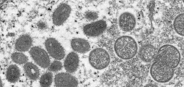 Microscope image of the monkeypox virus