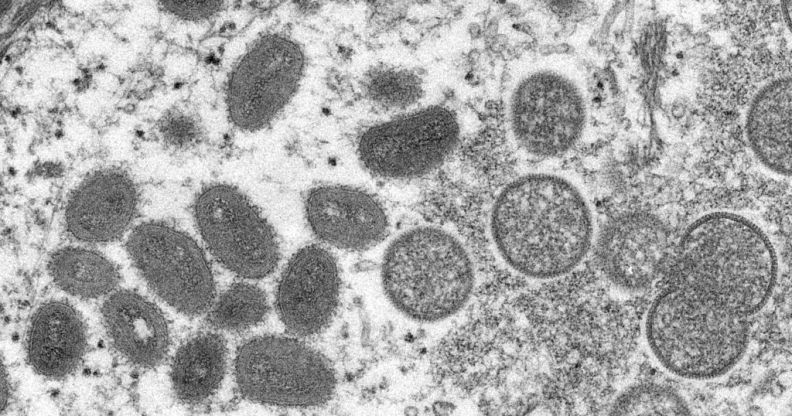 Microscope image of the monkeypox virus