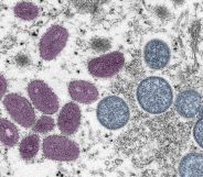 Digitally-colorized electron microscopic (EM) image depicting a monkeypox virion (virus particle)