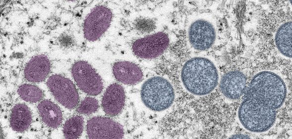 Digitally-colorized electron microscopic (EM) image depicting a monkeypox virion (virus particle)