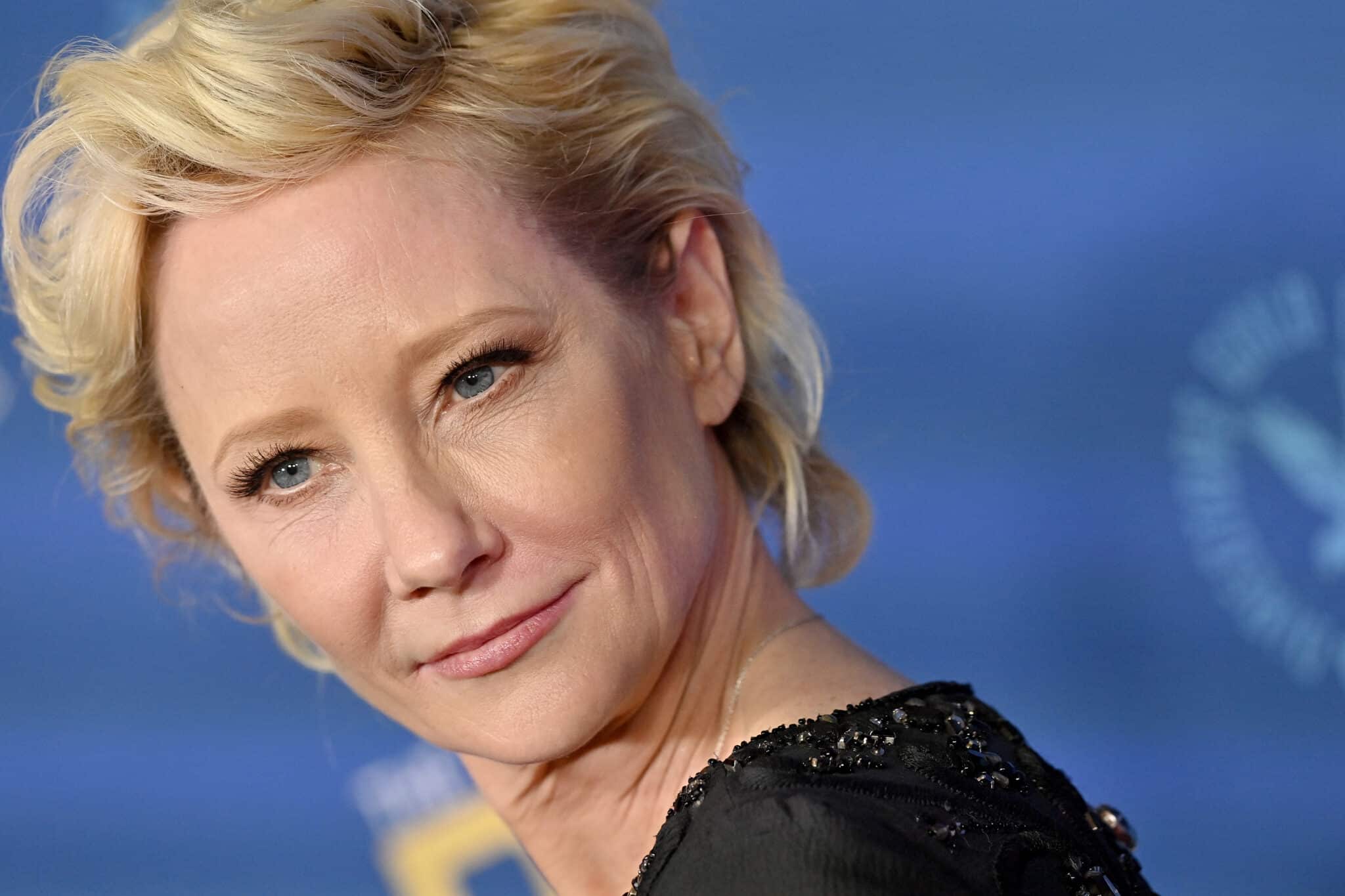 Anne Heche's cause of death ruled an accident following car crash