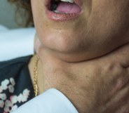 A stock photo of a woman with hands around her throat