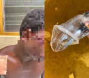 On the left: A man with his face blurred who has suffered a cut to his head. On the right: A pair of scissors wrapped up in a plastic bag