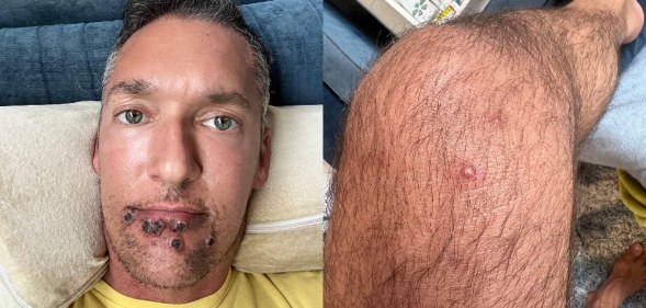 Side by side photo of Silver Steele with lesions under his chin and upper lip and leg