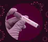A graphic with a dark purple tint across it and a virus image to the side shows a picture of a hand holding a test tube with monkeypox written on it