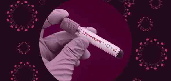 A graphic with a dark purple tint across it and a virus image to the side shows a picture of a hand holding a test tube with monkeypox written on it