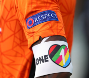 A closeup image of a player's arm from the Netherlands wearing a rainbow OneLove armband