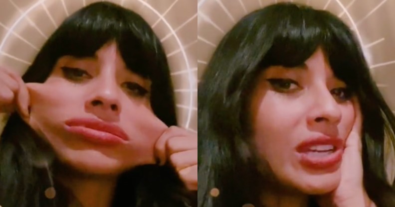 Two side-by-side images taken from actor Jameela Jamil's TikTok account show her pulling her face outward to demonstrate her 'elastic skin' caused by her Ehlers Danlos-Syndrome. The next image shows the actor just resting her head on her hand as she looks towards the camera