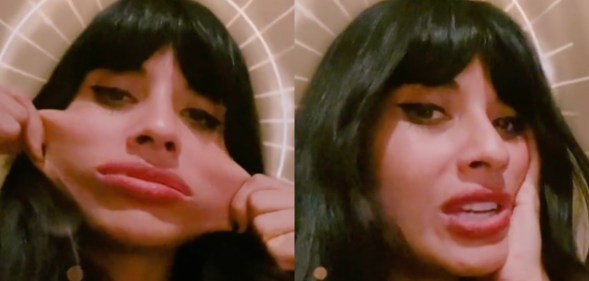 Two side-by-side images taken from actor Jameela Jamil's TikTok account show her pulling her face outward to demonstrate her 'elastic skin' caused by her Ehlers Danlos-Syndrome. The next image shows the actor just resting her head on her hand as she looks towards the camera
