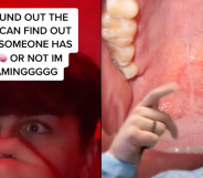 Screenshots from two tiktok videos explaining how dentists can tell when you've given a blowjob.