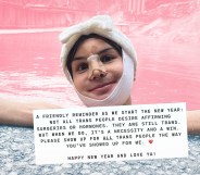 Dylan Mulvaney by the side of an outdoor pool, with a text box at the bottom detailing her recovering.