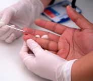 An image shows a person having a HIV test with a blood prick on their finger.