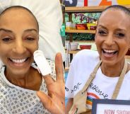 Adele Roberts (left) in hospital while undergoing treatment for bowel cancer and (right) on Celebrity Bake Off for Stand Up To Cancer