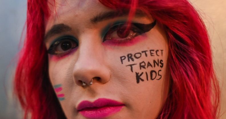 Young white person with red hair and 'protect trans kids' written on their cheek