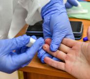 A person gets a finger prick test, often used to identify HIV.