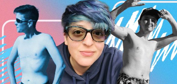 A graphic composed of images of trans and non-binary people who have had top surgery