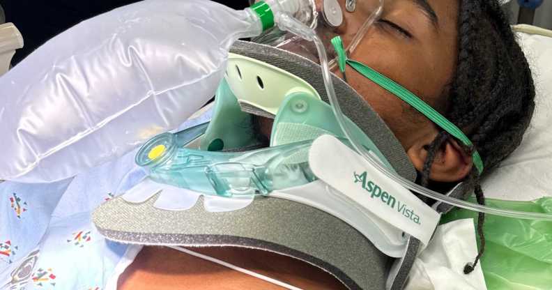 A 16-year-old spent days in intensive care after being attacked on Dockweiler Beach at a beach party on 10 February.