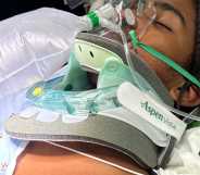 A 16-year-old spent days in intensive care after being attacked on Dockweiler Beach at a beach party on 10 February.