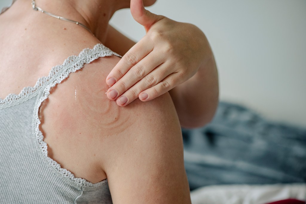 Image of a woman applying HRT gel on her shoulder
