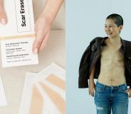 This skincare brand's 'innovative' product is helping LGBTQ+ people with their scars
