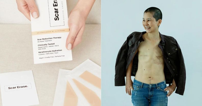 This skincare brand's 'innovative' product is helping LGBTQ+ people with their scars