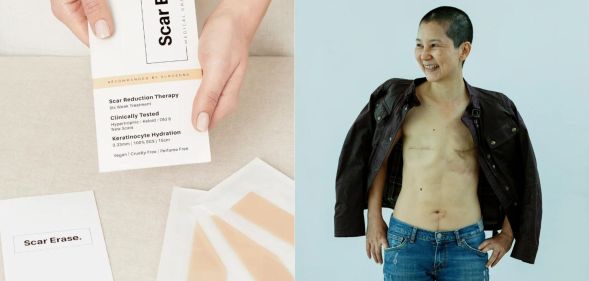 This skincare brand's 'innovative' product is helping LGBTQ+ people with their scars