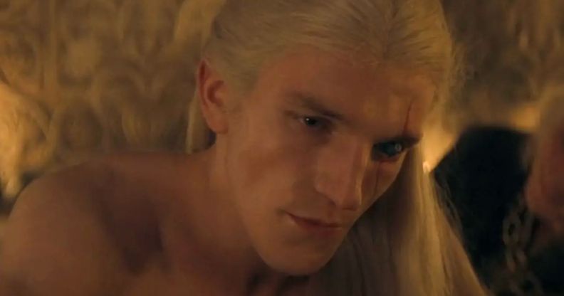 Ewan Mitchell as Aemond Targaryen in House of the Dragon.
