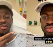 Lil Nas X showing off his paralysed face while in a hospital gown.