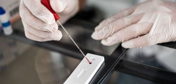 A researcher putting a pippet of blood in an HIV testing kit.