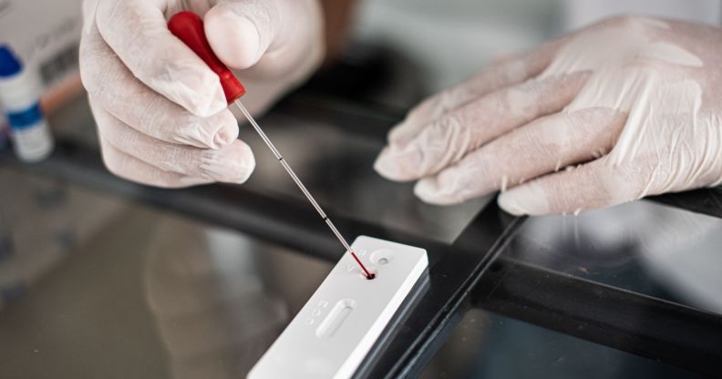 A researcher putting a pippet of blood in an HIV testing kit.