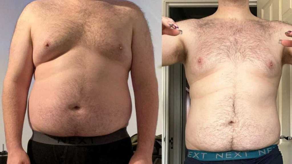 Georgie before and after taking Mounjaro.