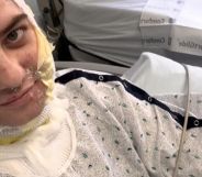 A picture of Diana in bandages during recovery from an acid attack.