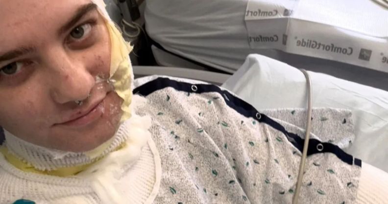 A picture of Diana in bandages during recovery from an acid attack.