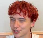 Rory went from identifying as a lesbian woman to coming out as a gay trans man.