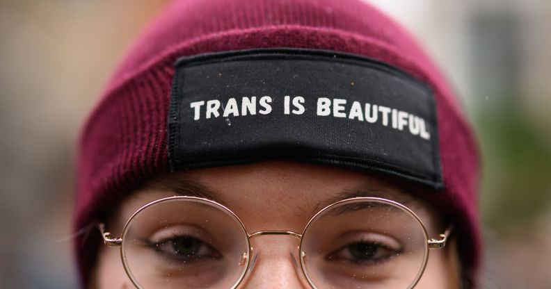 The upper-half of a person's head, wearing a hat that reads 'trans is beautiful'