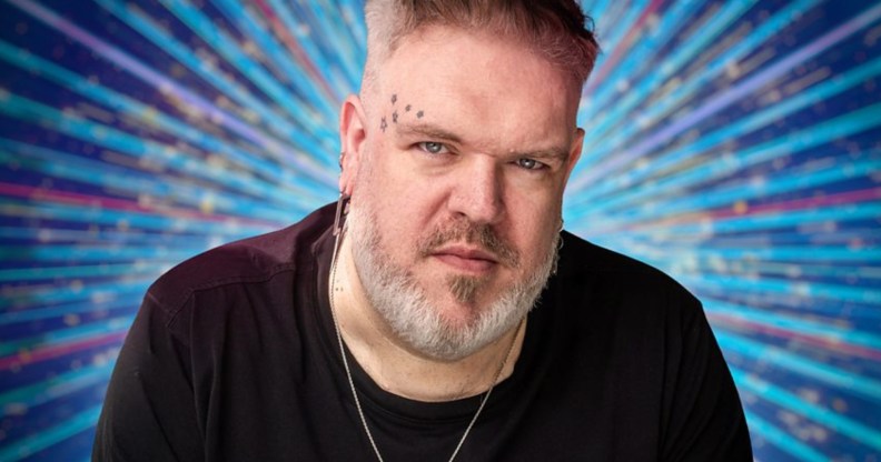 Kristian Nairn wearing a black t-shirt looking into camera with classic Strictly blue sparkles behind him.